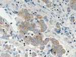 RAF1 Antibody in Immunohistochemistry (Paraffin) (IHC (P))