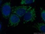 TOM70 Antibody in Immunocytochemistry (ICC/IF)