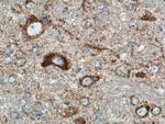 TOM70 Antibody in Immunohistochemistry (Paraffin) (IHC (P))