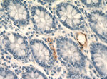 MAdCAM1 Antibody in Immunohistochemistry (Paraffin) (IHC (P))