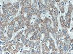 ATPB Antibody in Immunohistochemistry (Paraffin) (IHC (P))