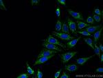 ATPB Antibody in Immunocytochemistry (ICC/IF)