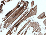 ATPB Antibody in Immunohistochemistry (Paraffin) (IHC (P))