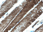 ATPB Antibody in Immunohistochemistry (Paraffin) (IHC (P))