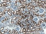 AGXT2 Antibody in Immunohistochemistry (Paraffin) (IHC (P))