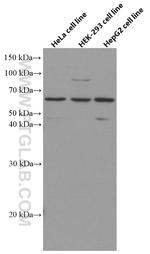 AGXT2 Antibody in Western Blot (WB)