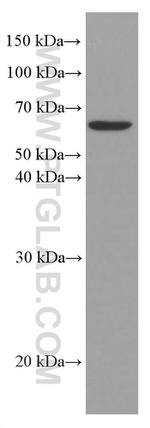 AGXT2 Antibody in Western Blot (WB)