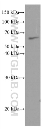 AGXT2 Antibody in Western Blot (WB)