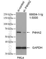 P4HA2 Antibody in Western Blot (WB)