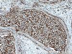 FYN Antibody in Immunohistochemistry (Paraffin) (IHC (P))