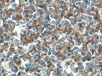 FYN Antibody in Immunohistochemistry (Paraffin) (IHC (P))