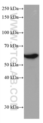 FYN Antibody in Western Blot (WB)