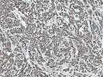 KU70/XRCC6 Antibody in Immunohistochemistry (Paraffin) (IHC (P))