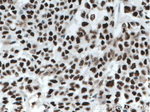 KU70/XRCC6 Antibody in Immunohistochemistry (Paraffin) (IHC (P))