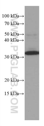 MMACHC Antibody in Western Blot (WB)