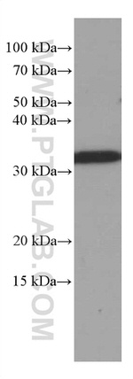 MMACHC Antibody in Western Blot (WB)