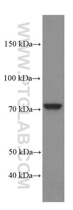 MTHFR Antibody in Western Blot (WB)