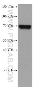 MTHFR Antibody in Western Blot (WB)