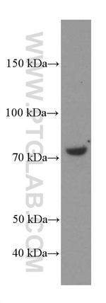 MTHFR Antibody in Western Blot (WB)