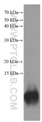 S100 beta Antibody in Western Blot (WB)