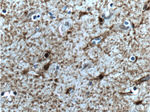 S100 beta Antibody in Immunohistochemistry (Paraffin) (IHC (P))