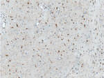 S100 beta Antibody in Immunohistochemistry (Paraffin) (IHC (P))