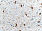 S100 beta Antibody in Immunohistochemistry (Paraffin) (IHC (P))