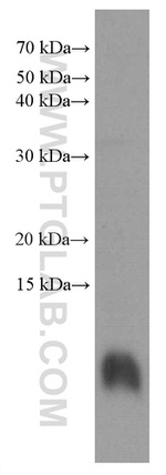 S100 beta Antibody in Western Blot (WB)