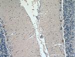 ACSL4 Antibody in Immunohistochemistry (Paraffin) (IHC (P))