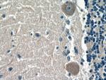 ACSL4 Antibody in Immunohistochemistry (Paraffin) (IHC (P))