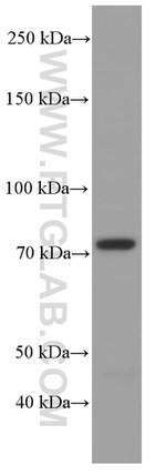 ACSL4 Antibody in Western Blot (WB)