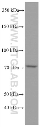 ACSL4 Antibody in Western Blot (WB)