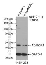 Adiponectin receptor 1 Antibody in Western Blot (WB)