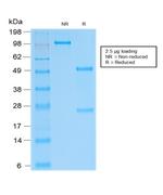 SOX9/SRY-box 9 Antibody in SDS-PAGE (SDS-PAGE)