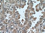 ADAM10 Antibody in Immunohistochemistry (Paraffin) (IHC (P))