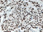 XRCC4 Antibody in Immunohistochemistry (Paraffin) (IHC (P))