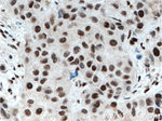 XRCC4 Antibody in Immunohistochemistry (Paraffin) (IHC (P))