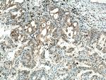 RABEPK/p40 Antibody in Immunohistochemistry (Paraffin) (IHC (P))