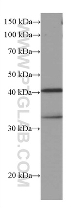 RABEPK/p40 Antibody in Western Blot (WB)