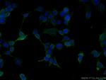 CHST4 Antibody in Immunocytochemistry (ICC/IF)