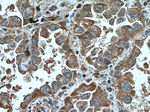 CHST4 Antibody in Immunohistochemistry (Paraffin) (IHC (P))