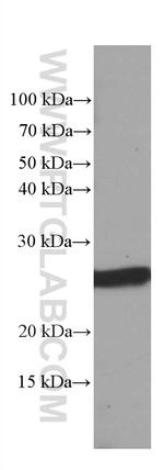 GSTA1 Antibody in Western Blot (WB)