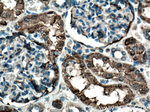 GSTA1 Antibody in Immunohistochemistry (Paraffin) (IHC (P))