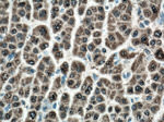 GSTA1 Antibody in Immunohistochemistry (Paraffin) (IHC (P))