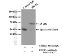 RIC8A Antibody in Immunoprecipitation (IP)