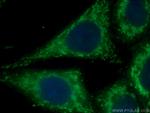 cIAP1 Antibody in Immunocytochemistry (ICC/IF)