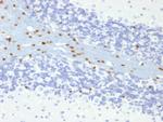 SOX10 (Melanoma Marker) Antibody in Immunohistochemistry (Paraffin) (IHC (P))