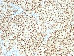 SOX10 (Melanoma Marker) Antibody in Immunohistochemistry (Paraffin) (IHC (P))