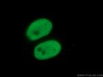 KAP1 Antibody in Immunocytochemistry (ICC/IF)