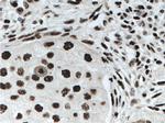 KAP1 Antibody in Immunohistochemistry (Paraffin) (IHC (P))